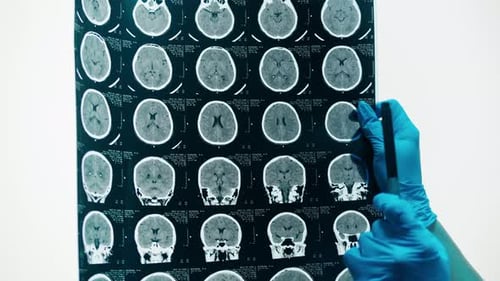 Doctor Examines Brain Scan in Hospital