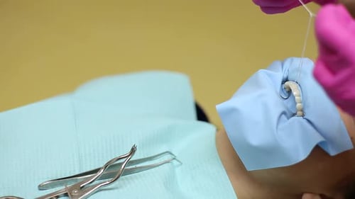 Blanchiment des dents. Application de la dernière technologie, blanchiment à froid des dents