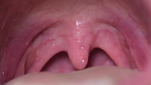 Human Mouth Interior Close Up Medical Footage
