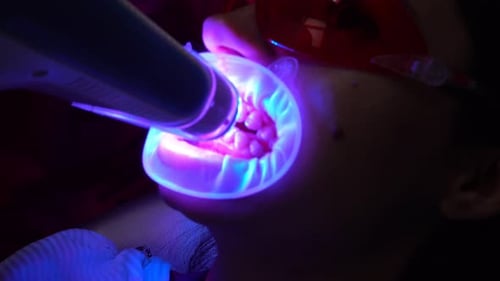 Dental Exam with Blue Lighting Close Up