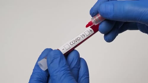 Positive Covid-19 Blood Test Marked by Technician
