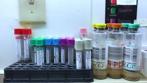 Specimen blood work laboratory tubes and medical equipment in a hospital setting