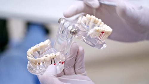 Teeth treatment and cure. Close up view of doctor holding plastic model of teeth
