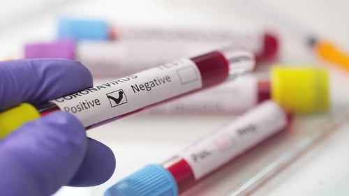 Gloved Hand Marks Coronavirus Blood Test Positive