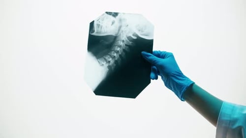 Arm Holds Neck and Head Medical X-Ray