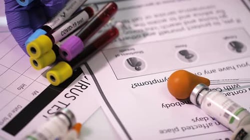 Medical Tests for Virus on Desk