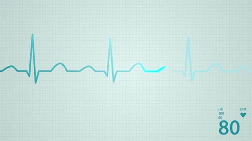 Animation of a schematic diagram of normal sinus rhythm for a human heart