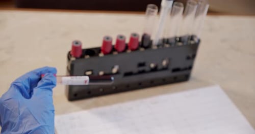 Doctor's Arm in Protective Suit Antiviral Holds Medical Test Tube with Blood Labeled Coronavirus