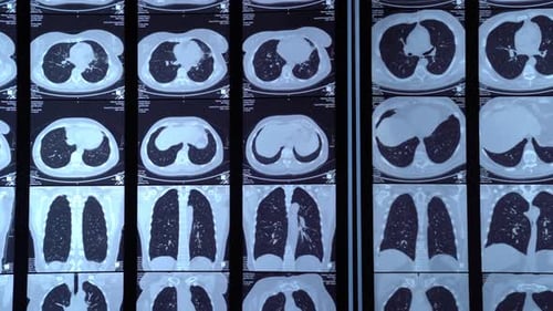 X-rays of light