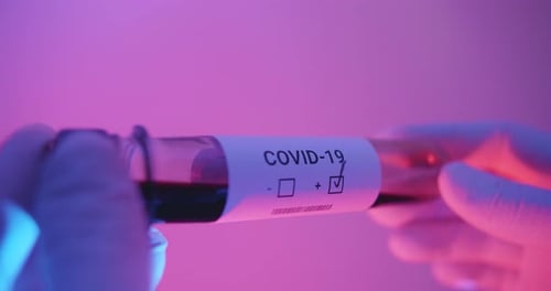 Hand Holding COVID-19 Positive Blood Sample