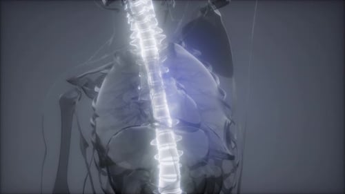 Backache in Back Bones