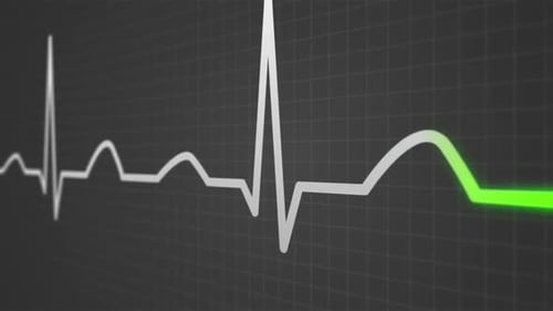 Digital Heartbeat Line Monitor Loop