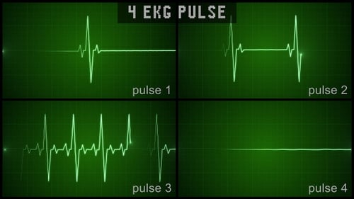 EKG Pulse Heartbeat Animations with Medical Monitor Grid