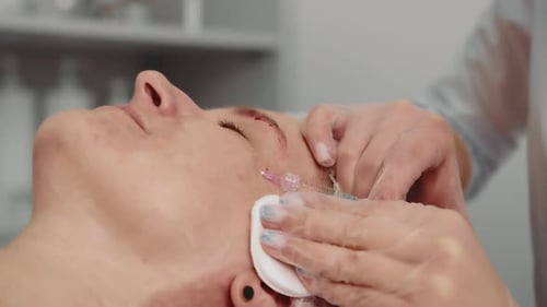 Close Up of Botox Injections in Woman's Face