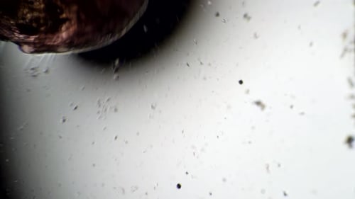 Un ver agité se déplace dans le microscope