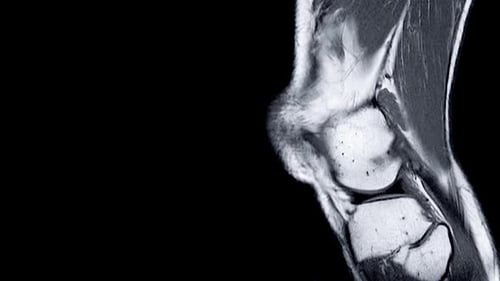 Knee MRI Animated Scan Diagnostic Image