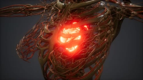 CG Animation Of A Sick Human Heart