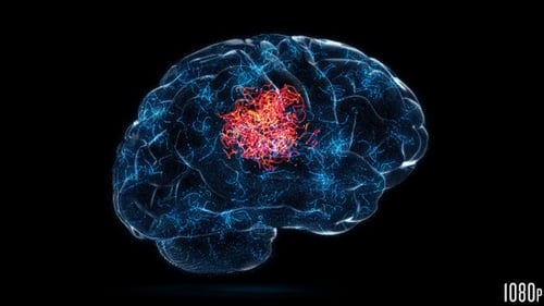 Concepto de cerebro aislado idea o problema dolor de cabeza
