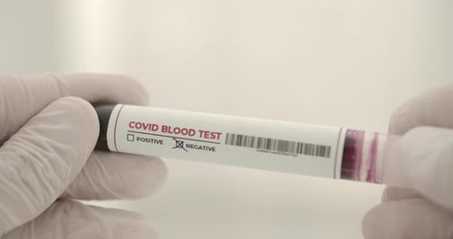 Negative Test
