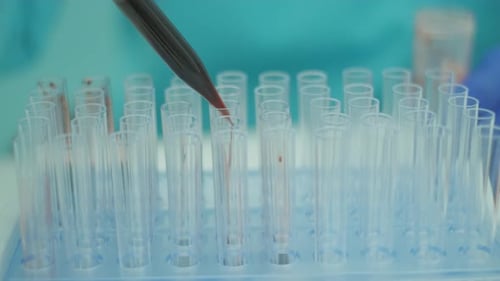 Blood Samples Being Placed into Test Tubes