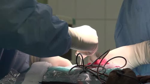 Surgeons Perform Operation in Operating Room