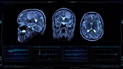Futuristic Brain Scan Medical HUD Interface with Data
