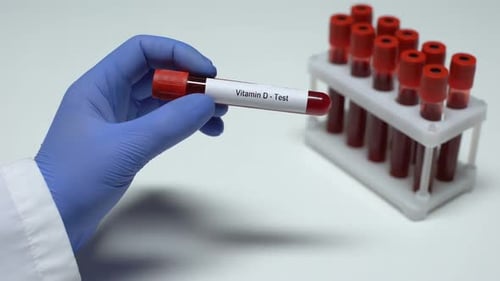Vitamin D, Arzt zeigt Blutprobe im Röhrchen, Laborforschung, Gesundheitsuntersuchung