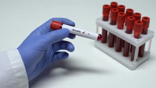 Negativer Brucella-Test