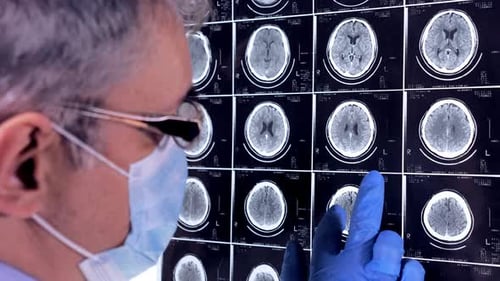 Doctor Neurologist Looking An Mri