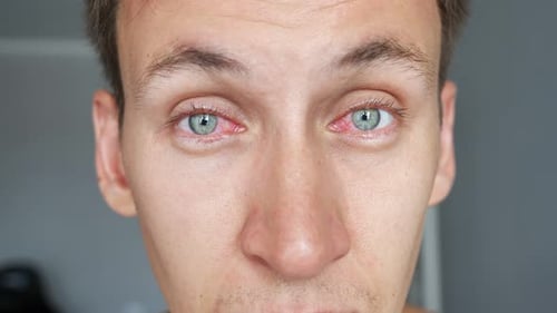 Jeune homme aux yeux rouges