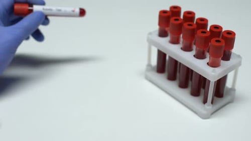 Positiver Röteln-Test, Arzt zeigt Blutprobe, Laborforschung, Gesundheitsuntersuchung