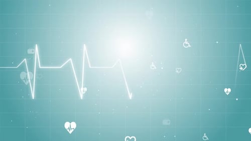 Graph of Heart Rhythm Heartbeat monitor EKG line monitor.