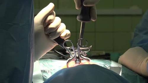 Surgeons Performing Surgery with Surgical Tools