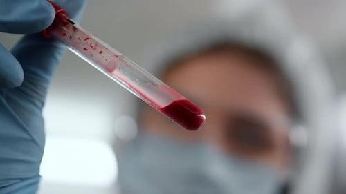 Doctor Holds Vial of Blood in Lab Close Up