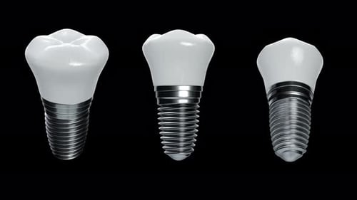 3D Dental Implant Assembly and Disassembly Animation