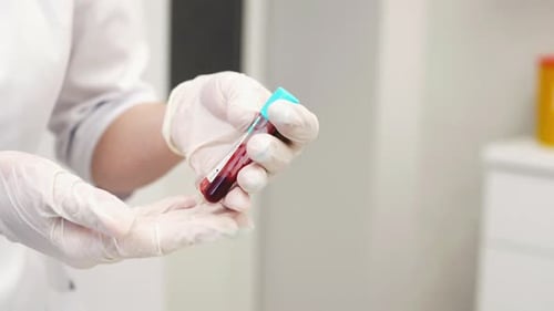 Blood Sample in Vial Held by Gloved Hand