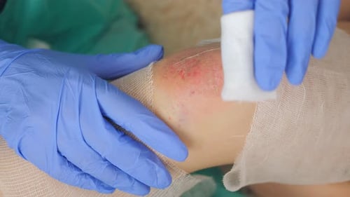 Bandage Being Applied to Wound by Doctor