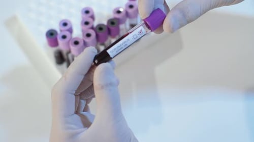 Positive Coronavirus Blood Test in Lab Setting