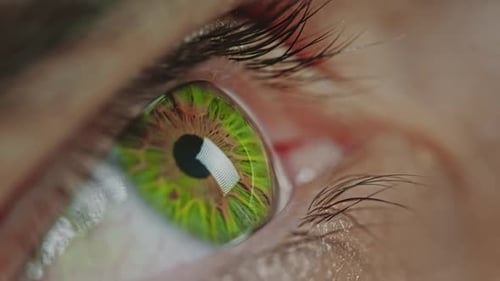 Auge