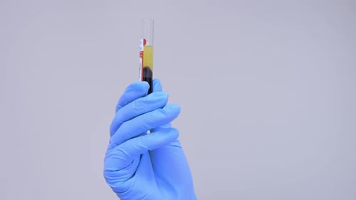 Gloved Hand Holding Separated Blood Sample in Test Tube