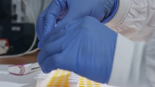 Scientist examining frozen samples takes out of deep freezing in a lab