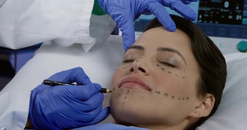 Woman Receiving Facial Markings Before Cosmetic Surgery