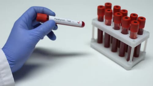 Gloved Hand Holds Vial of Positive Blood Test