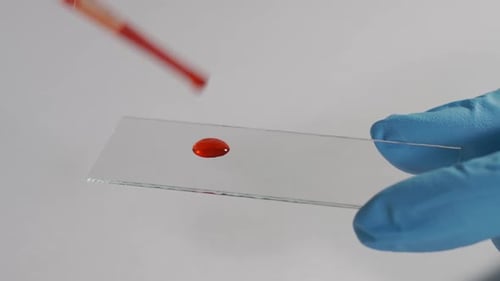 Der Arzt führt eine Laborblutuntersuchung des Patienten durch