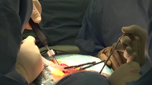 Surgeons Operate Using Medical Equipment in Hospital