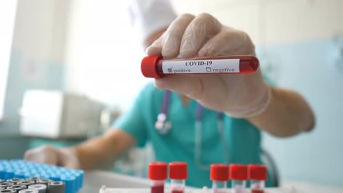 Doctor Holding COVID-19 Positive Blood Sample in Lab