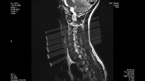MRI Scan of Human Head and Neck