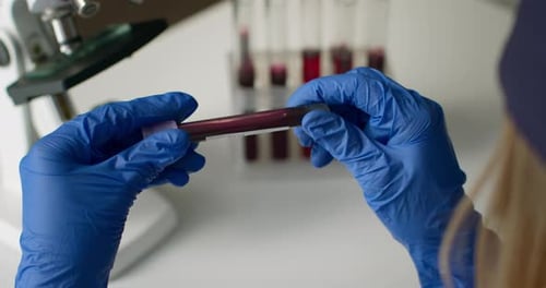 Close-up Shot. The Doctor Is Holding a Test Tube with a "Positive" Test for COVID-19. Experiments in