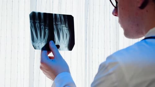Doctor Examines Hand X-Ray by Window