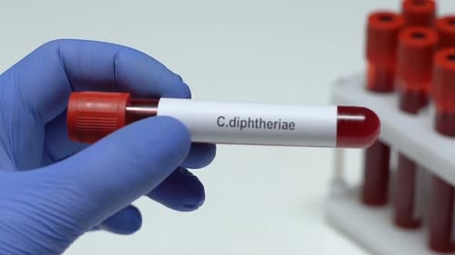 C. Diaphtherie, Arzt, der Blutprobe im Röhrchen hält, Nahaufnahme, Gesundheitsuntersuchung